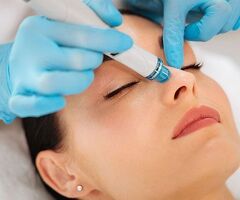 Carbon Laser Treatment Cost in Jaipur